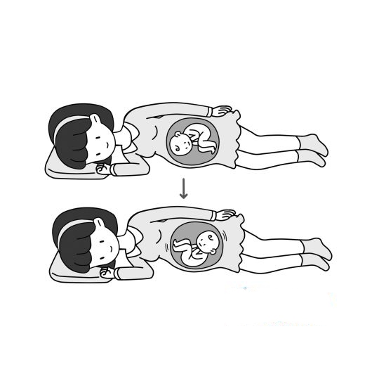 "臀位"宝宝如何转正?